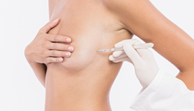 Breast Augmentation