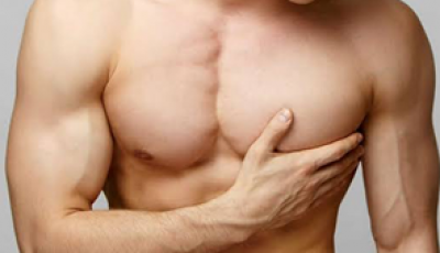 Gynecomastia Surgery