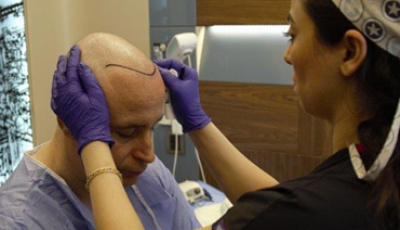 Почему именно в Турции так развиты центры пересадки волос? 