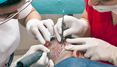 What Are Painless Hair Transplantation Methods?