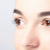 Can Eyebrow Transplantation Be Performed With FUE Method?