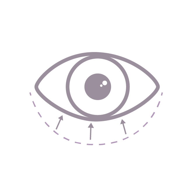 Tratamiento de ojo